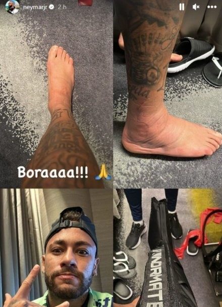 lesion de neymar - trak