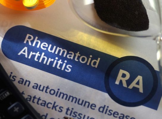 artritis reumatoide